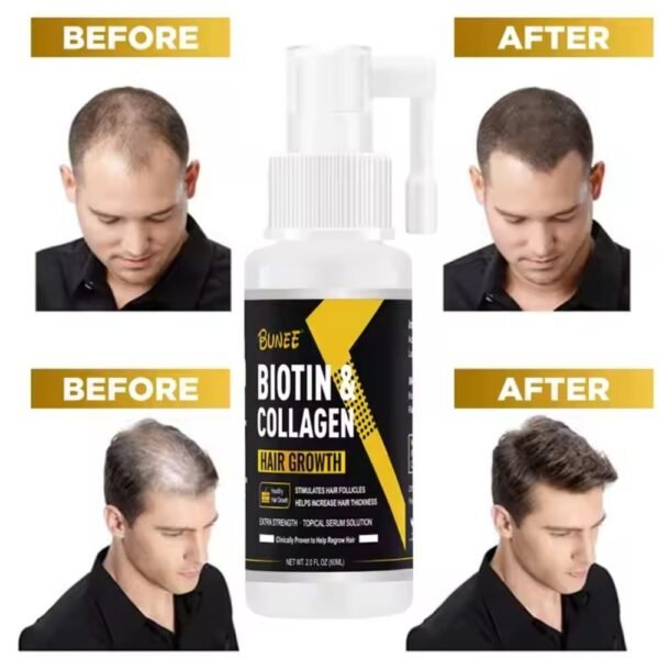 Biotin & Collagen Hair Growth in Pakistan